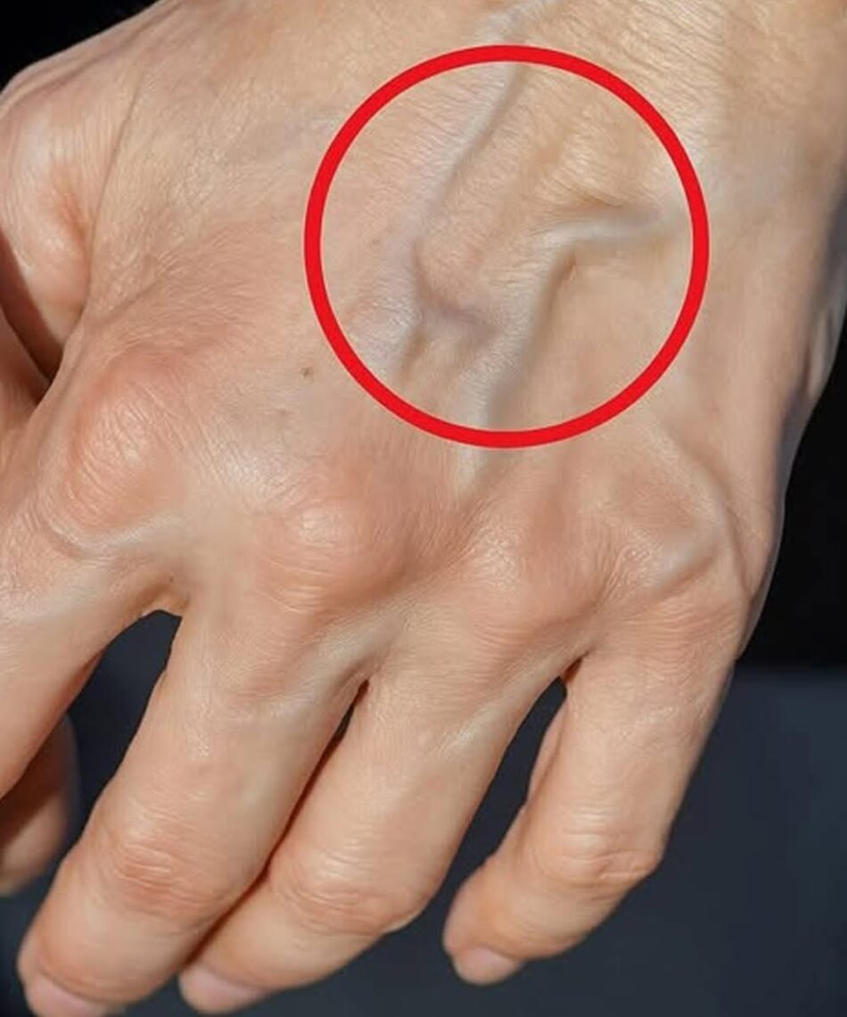 Health If you have visible veins, this means that…